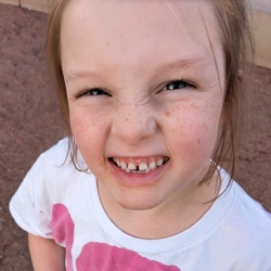 Fundraising Page Image